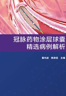 异常咖啡馆